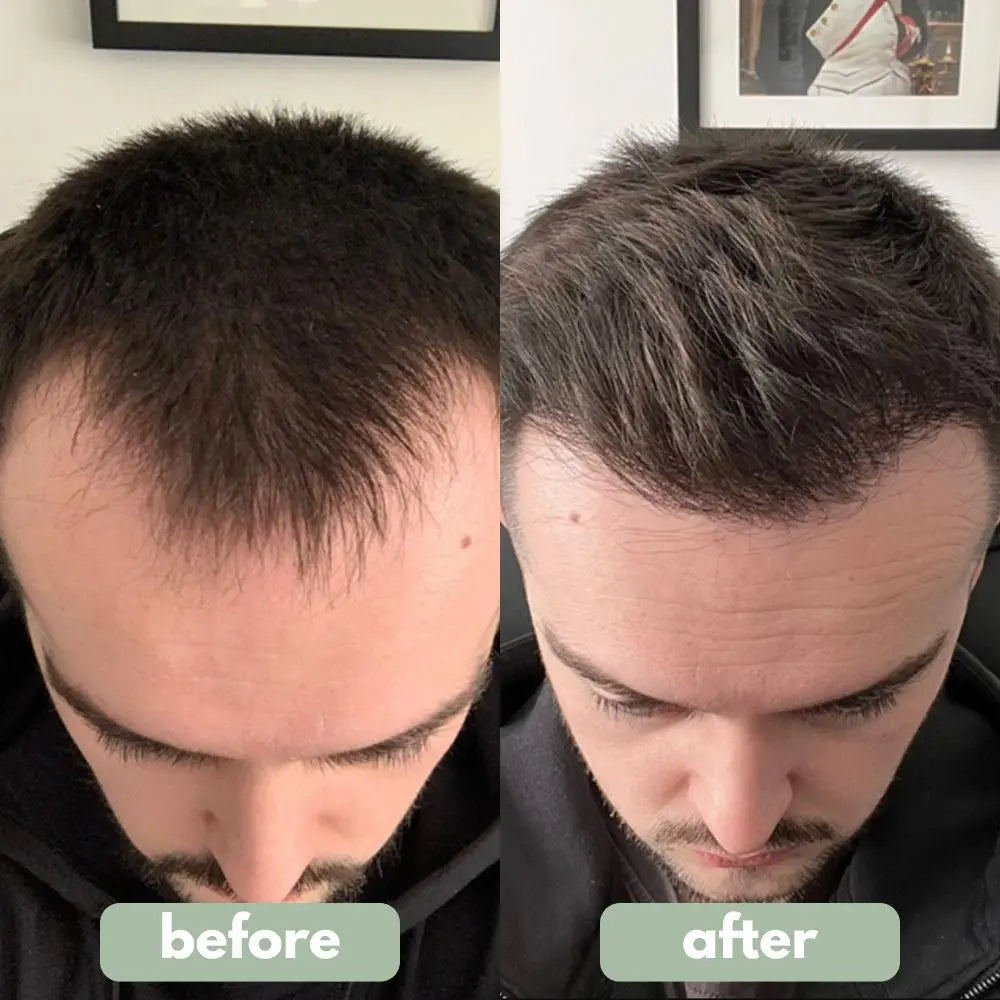 Hair Growth Serum null
