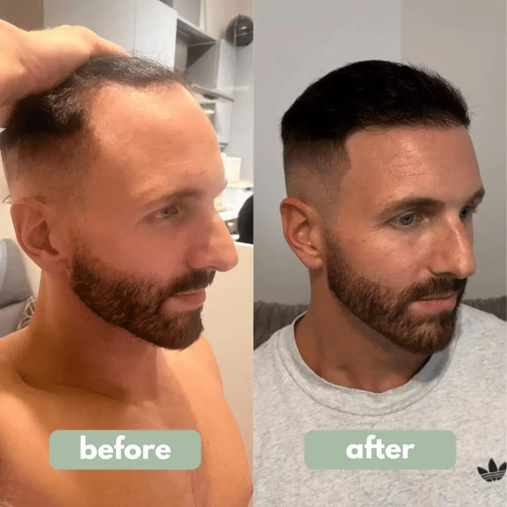 Hair Growth Serum null