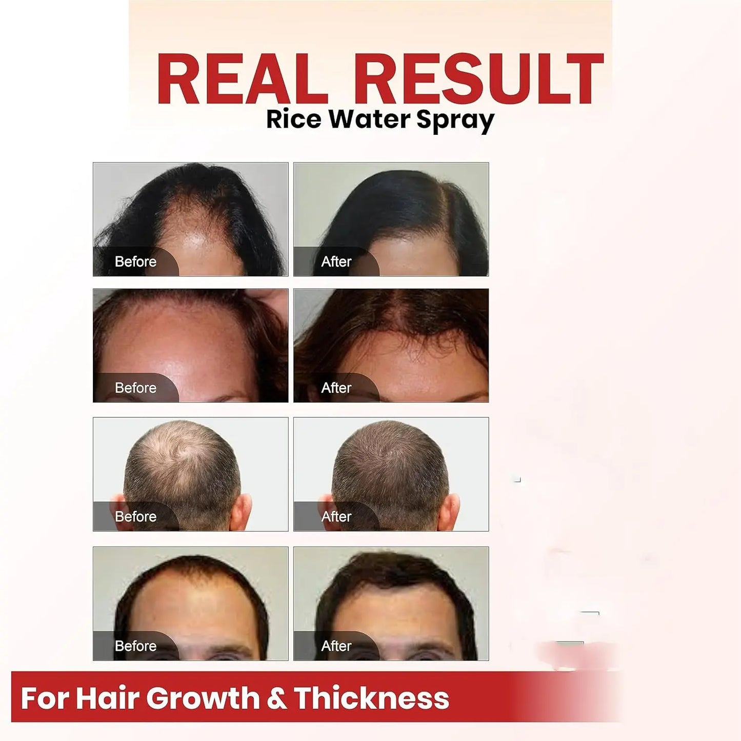 Hair Growth Spray Batana Oil Spray Natural Hair Growth Spray ShopaVibe