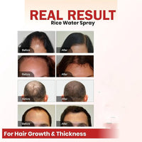 Hair Growth Spray Batana Oil Spray Natural Hair Growth Spray ShopaVibe