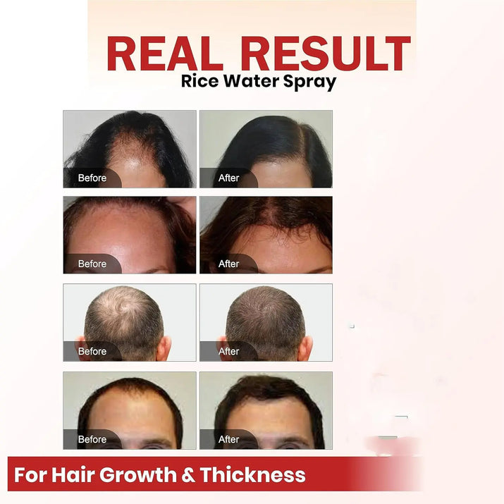 Hair Growth Spray Batana Oil Spray Natural Hair Growth Spray ShopaVibe