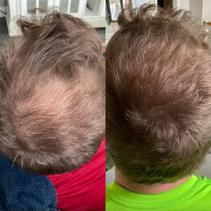 Hair Growth Serum null