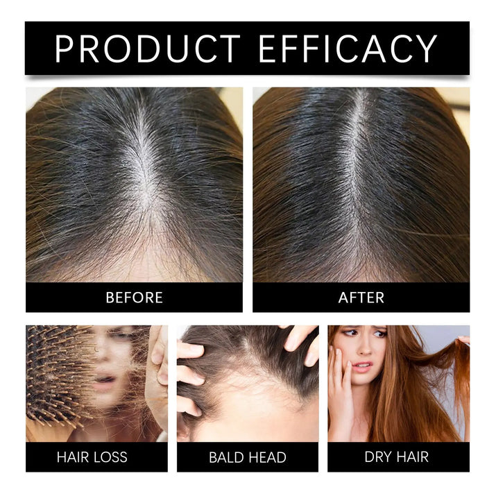 Marjoran Mi Hair Oil Moisture Replenishment Hair Essence For Repairing Dry And Manic Hair ShopaVibe