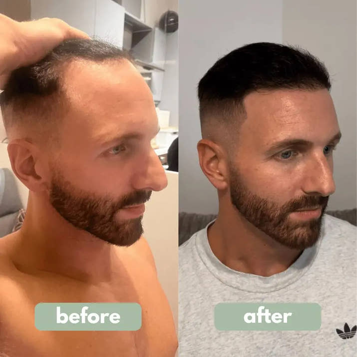 Hair Growth Serum null