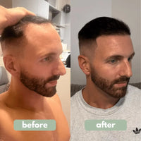 Hair Growth Serum null